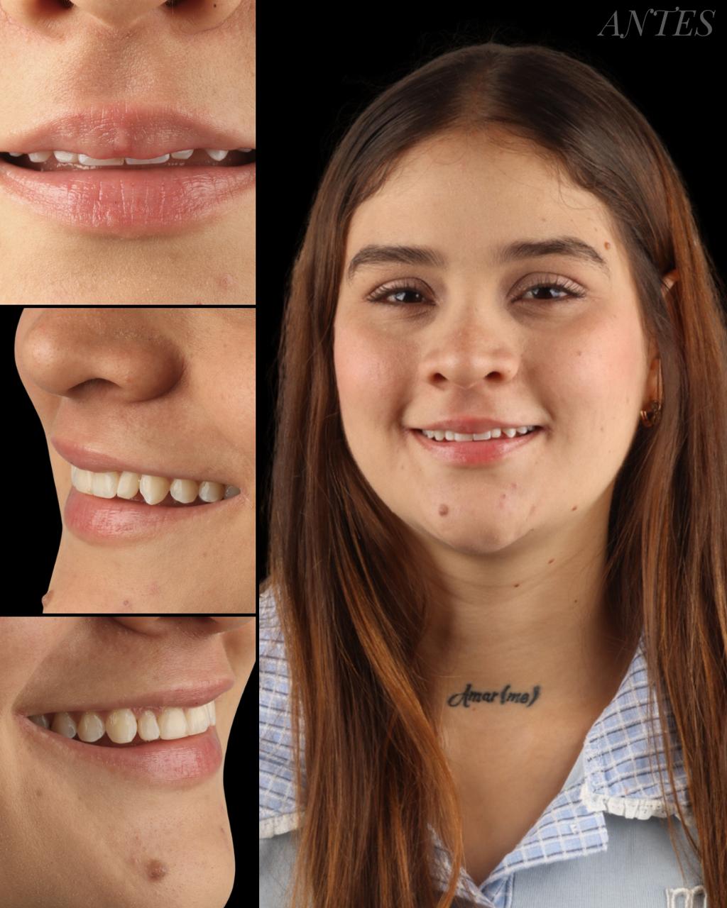 Caso odontología estética