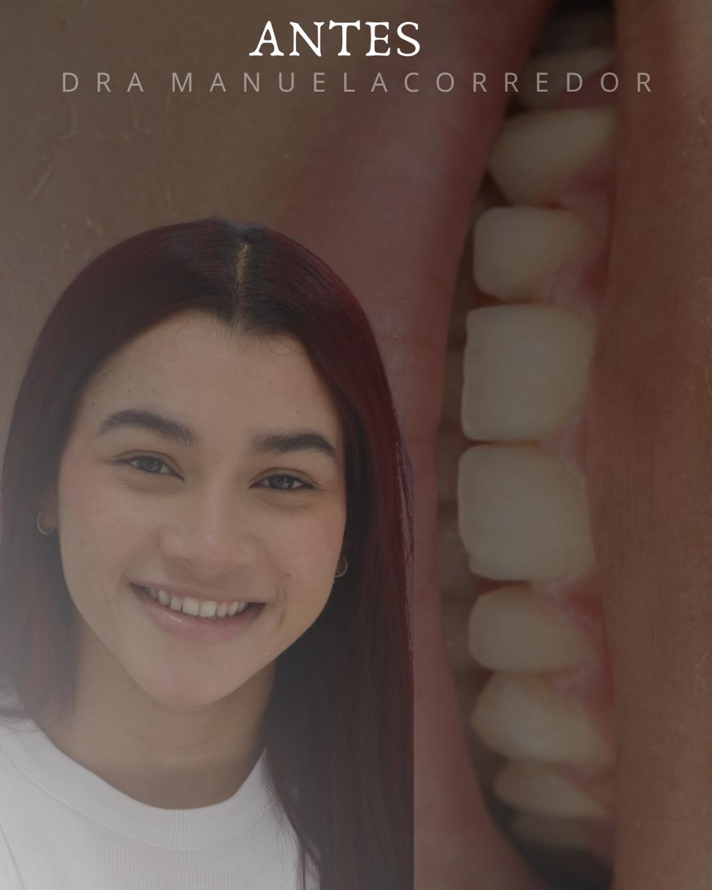 Procedimiento de diseño de sonrisa