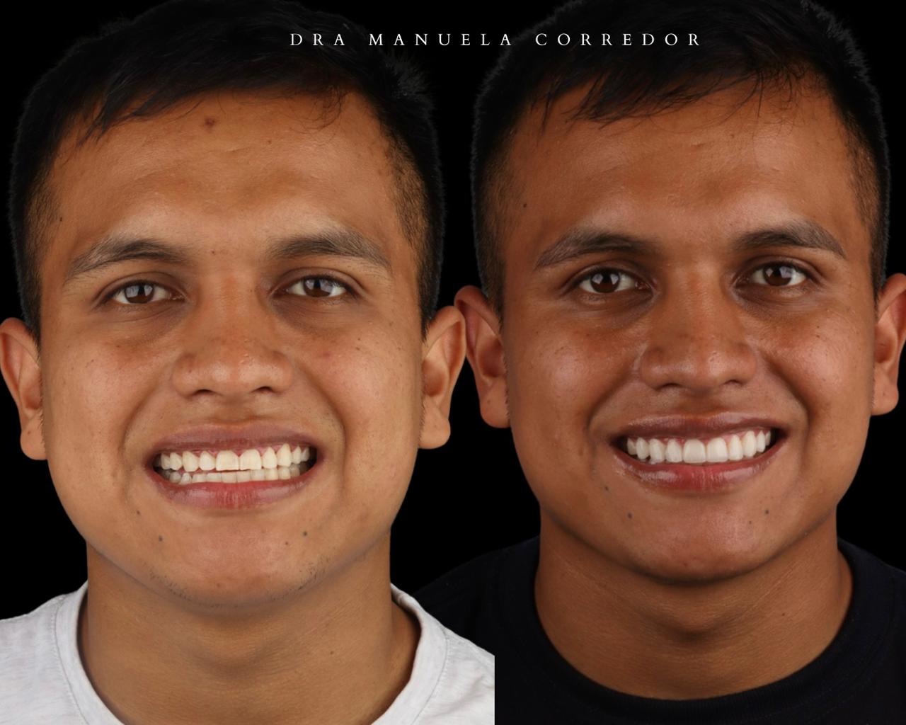 Caso clínico sonrisa