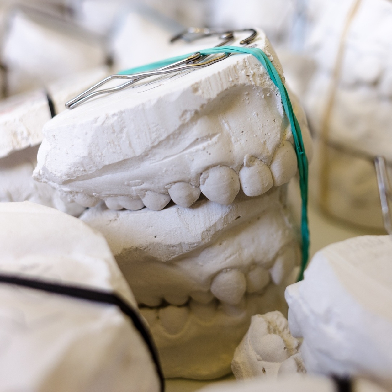 Molde dental para prótesis